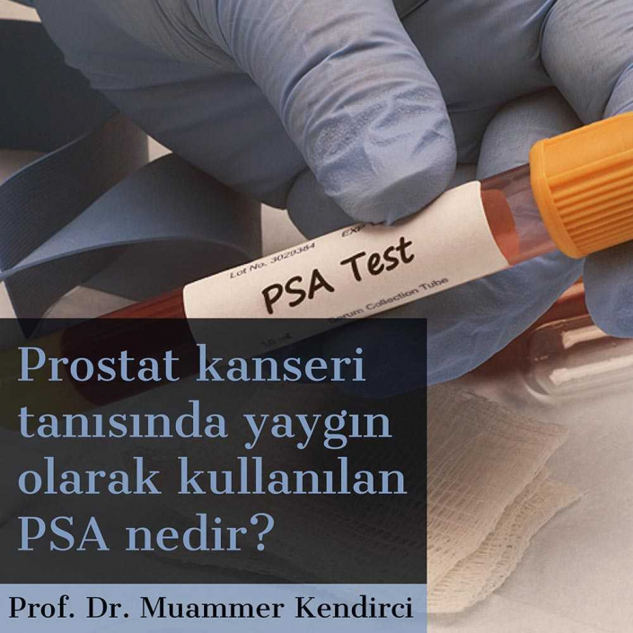 PSA testi nedir - Prof. Dr. Muammer Kendirci